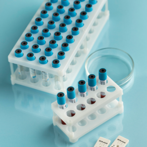 توالی‌یابی ژن‌ها (Single Gene Sequencing)